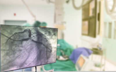 Internal Jugular, Femoral, and Axillary Lines