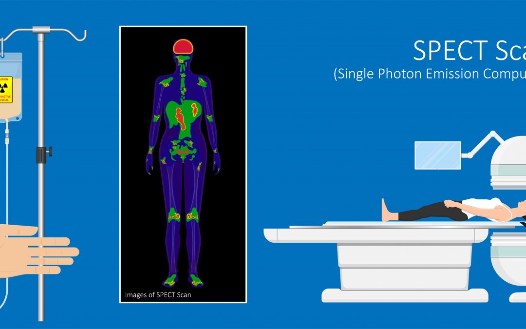 Radiopharmaceutical Extravasations & Nuclear Medicine Vascular Wellness