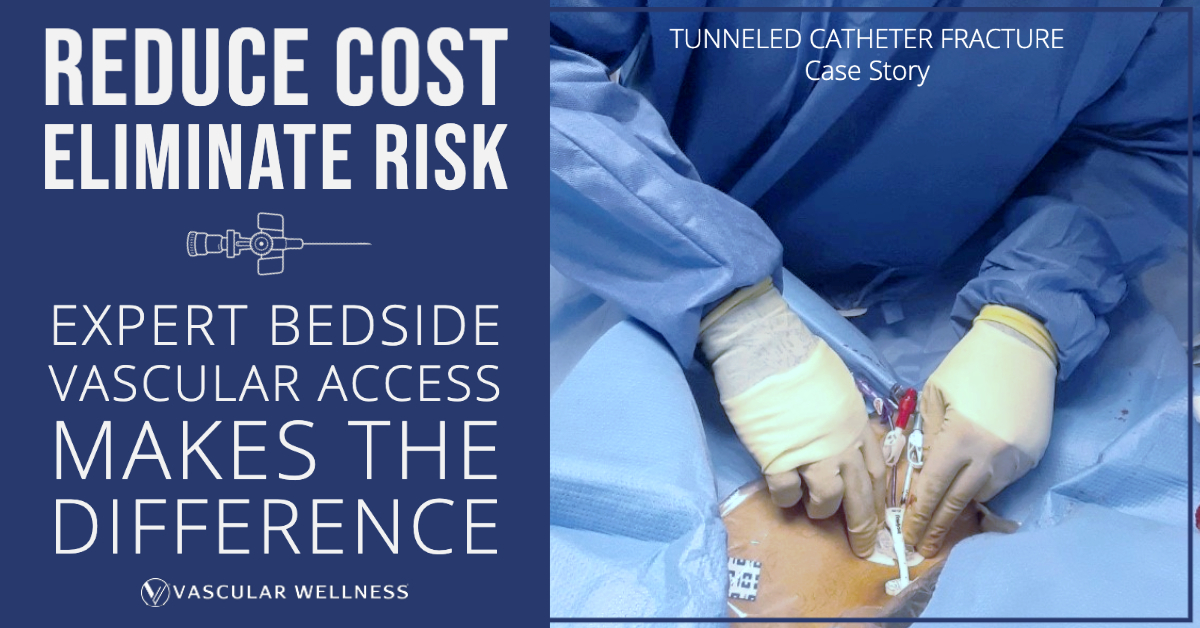 Tunneled Catheter Fracture Vascular Wellness