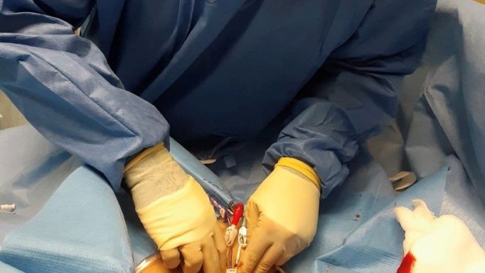 Tunneled Catheter Fracture – Nurse Clinicians in Action-04