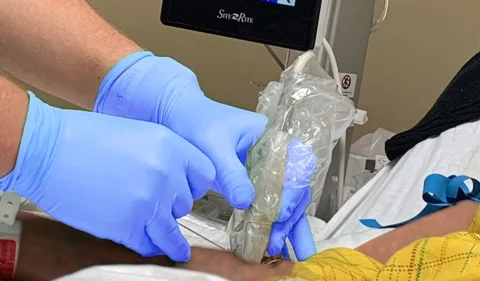 Ultrasound Guided PIV placement from Vascular Wellness