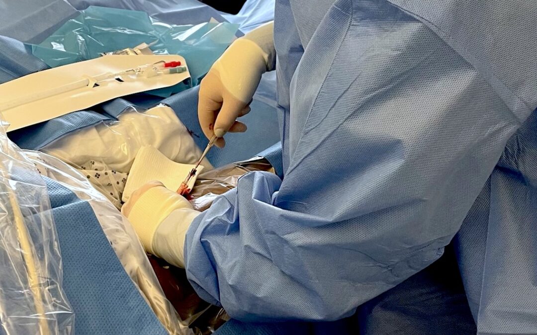 Intubated Patient Needs Vascular Access After Failed Attempts – Nurse Clinicians in Action-11