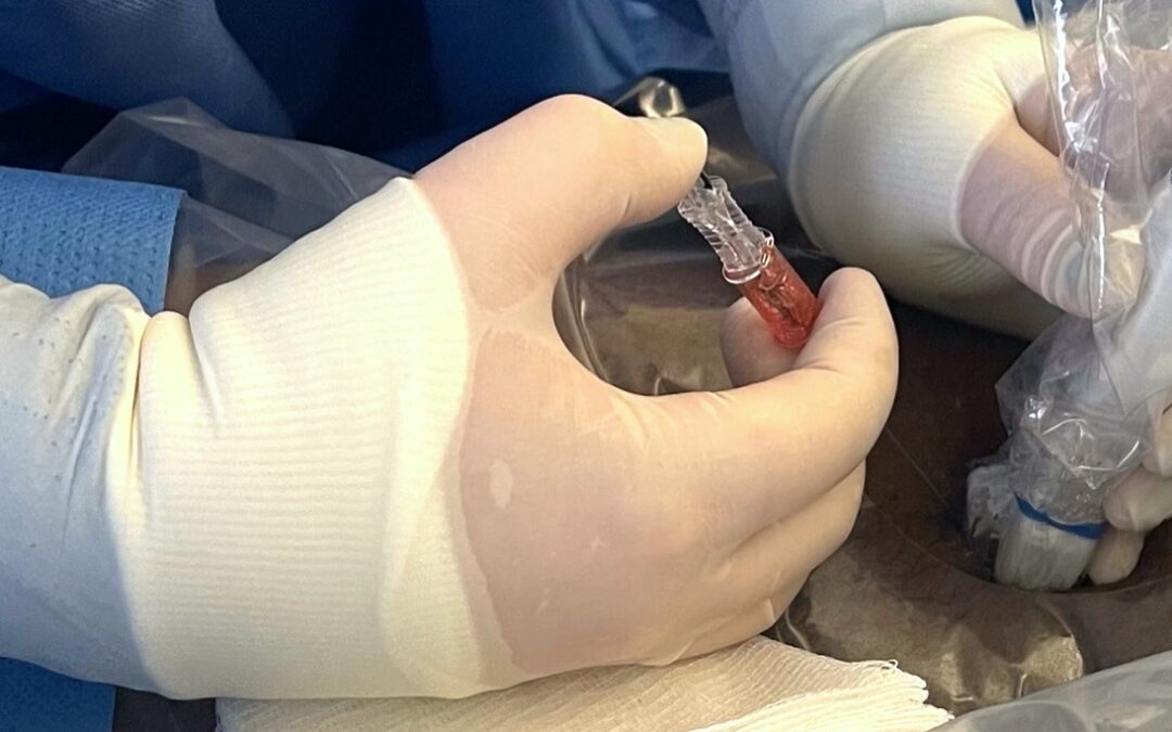 Nurse-placed Dialysis Catheters at the Bedside