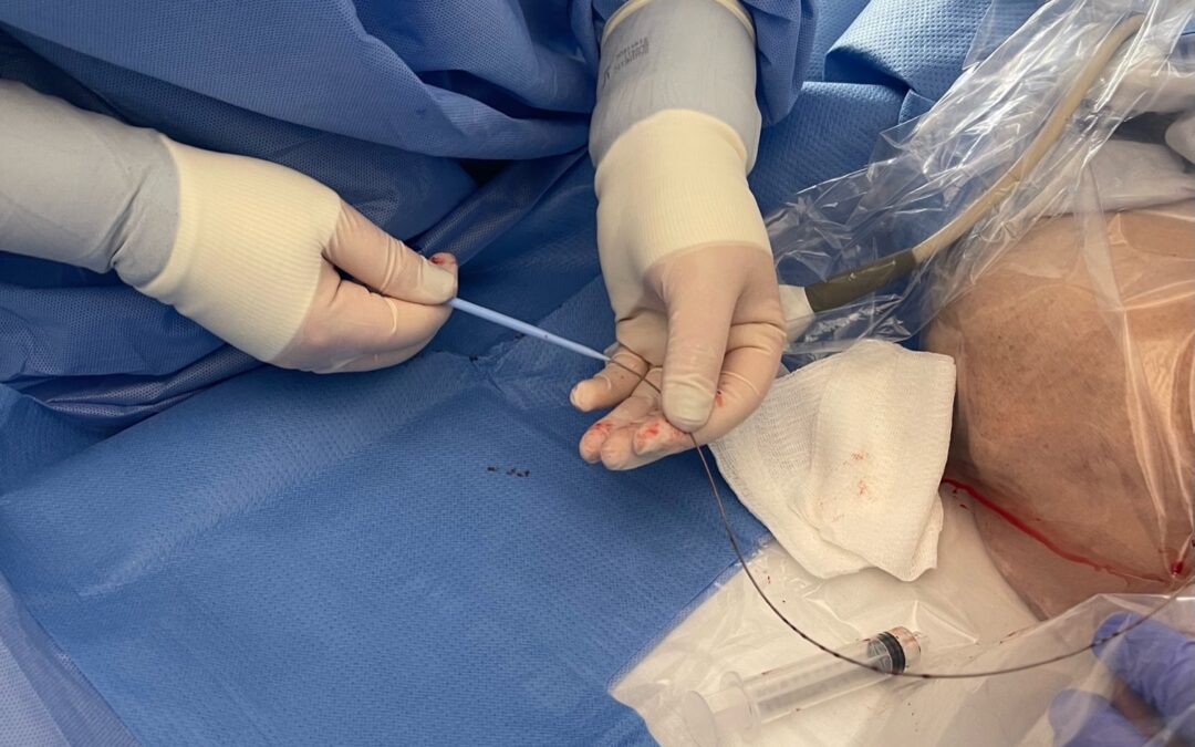 Emergent Temporary Dialysis Catheter – Nurse Clinicians in Action – 23