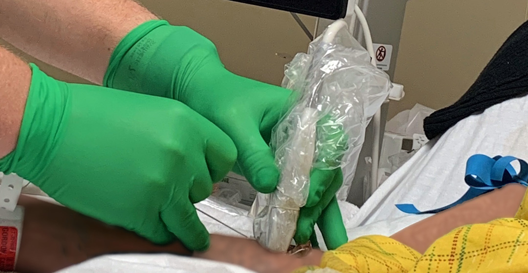 Fracture and Extravasation Complicates Vascular Access – Nurse Clinicians in Action – 25