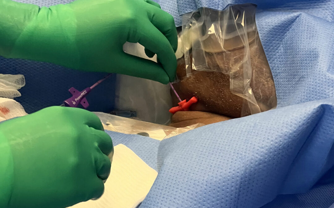 Implanted Port Obstructs PICC Insertion – Nurse Clinicians in Action – 29