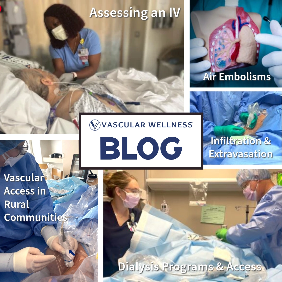 Vascular-Wellness_vascular-access-blog2 Vascular Wellness vascular access Blog - articles and insights about vascular access best practices
