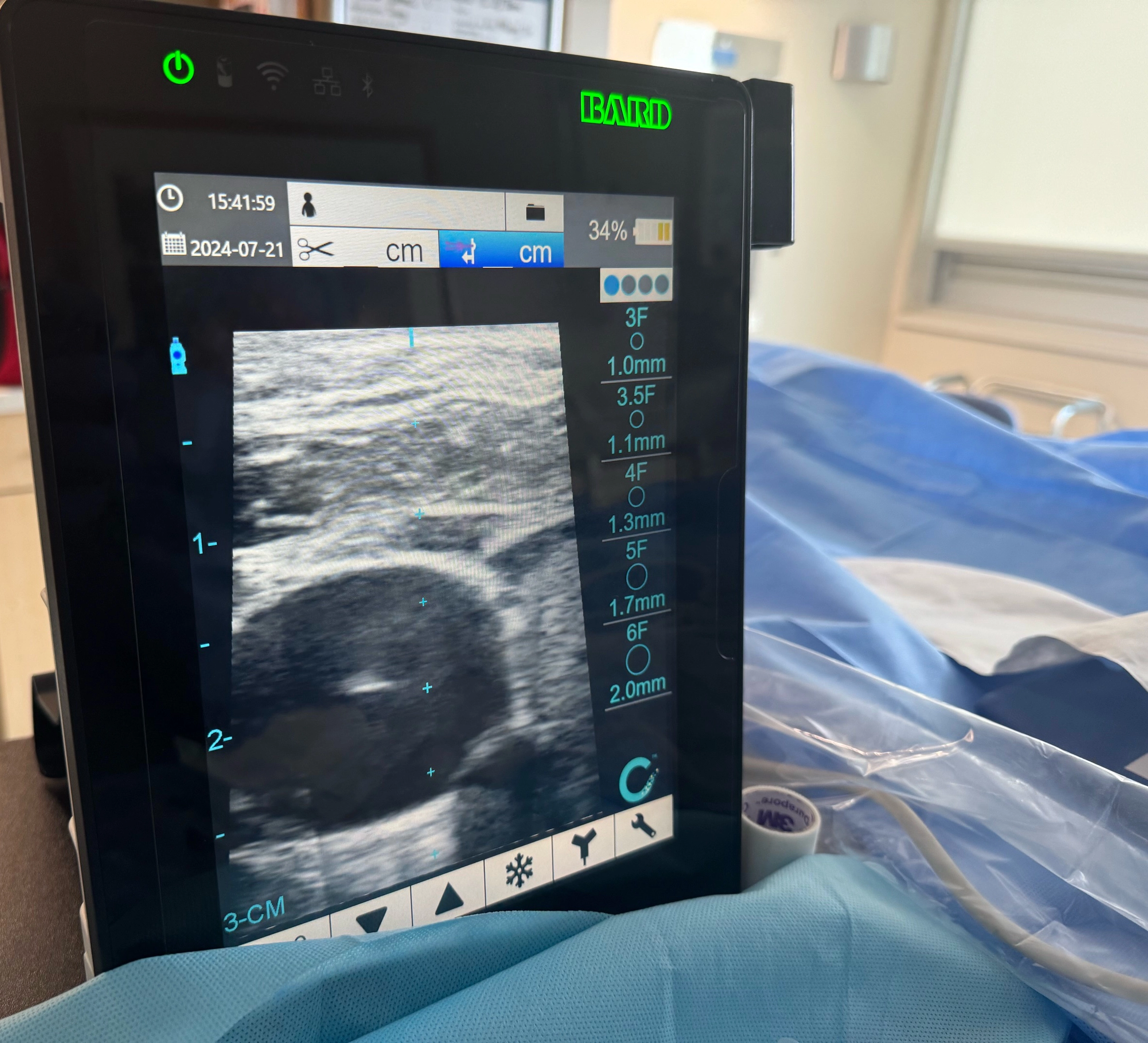 ultrasound-vein-visualization Vein visualization using ultrasound guidance from Vascular Wellness