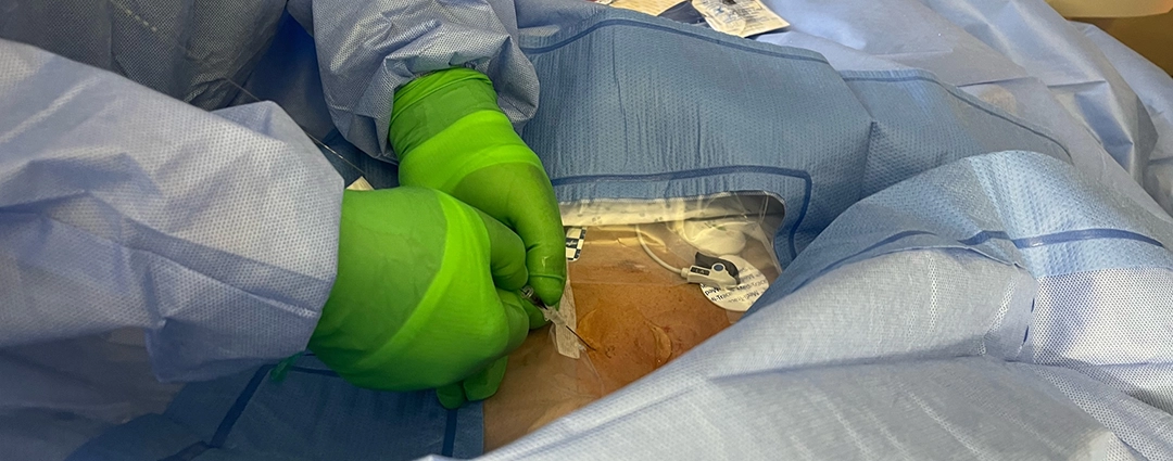 Urgent Vascath and Axillary Line – Nurse Clinicians in Action – 56