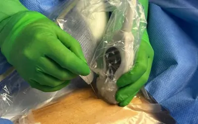 Dialysis Catheter, Mid-Thigh Femoral in Emergency Department – Nurse Clinicians in Action – 57