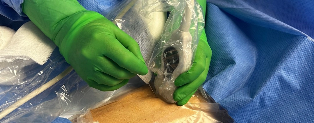 Dialysis Catheter, Mid-Thigh Femoral in Emergency Department – Nurse Clinicians in Action – 57